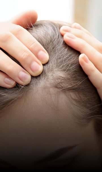 hair loss and thinning treatments